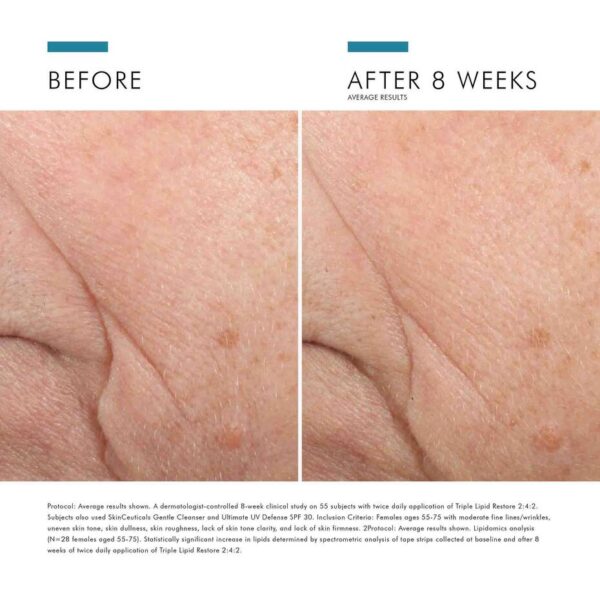 Triple Lipid Restore 2:4:2 - Image 10